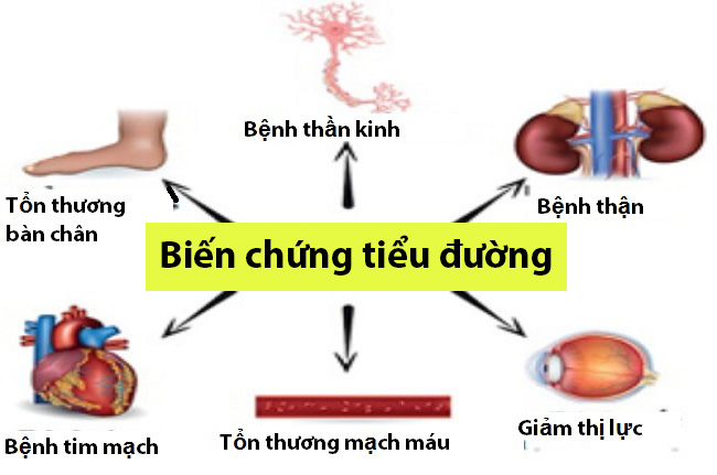 NHỮNG KHÁCH HÀNG CÓ NGUY CƠ CAO BỆNH TIỂU ĐƯỜNG NÊN CHỌN DOANH NGHIỆP BẢO HIỂM NÀO?